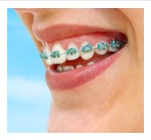 Orthodontist in San Francisco